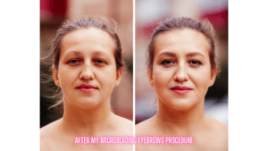 my microblading eyebrows before and after