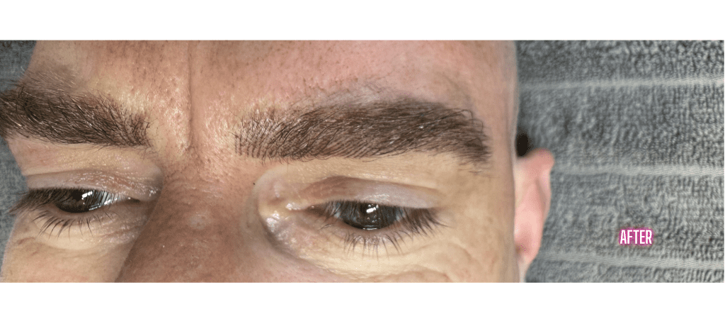perfect eyebrows for patchy and missing eyebrows after eyebrow correction in sydney at sydney microblading 